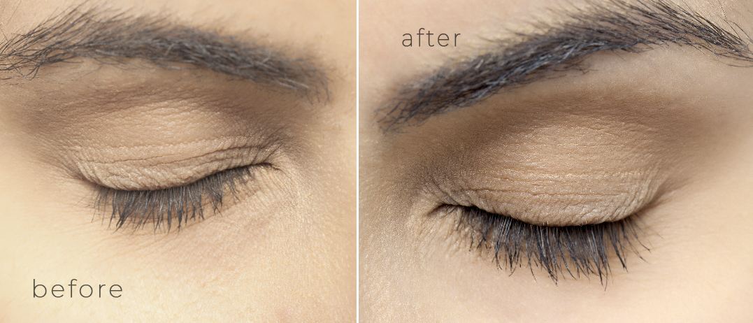 Nanolash eyelash serum before and after